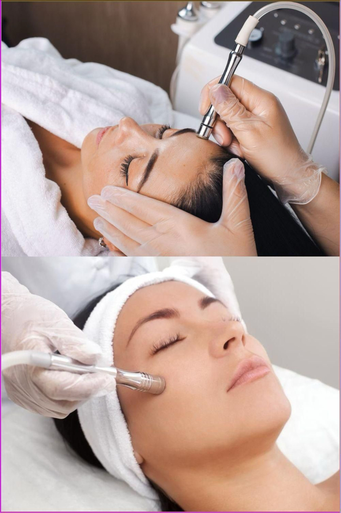 Microdermabrasion Facial