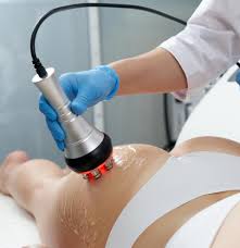 Cellulite Combo Treatment