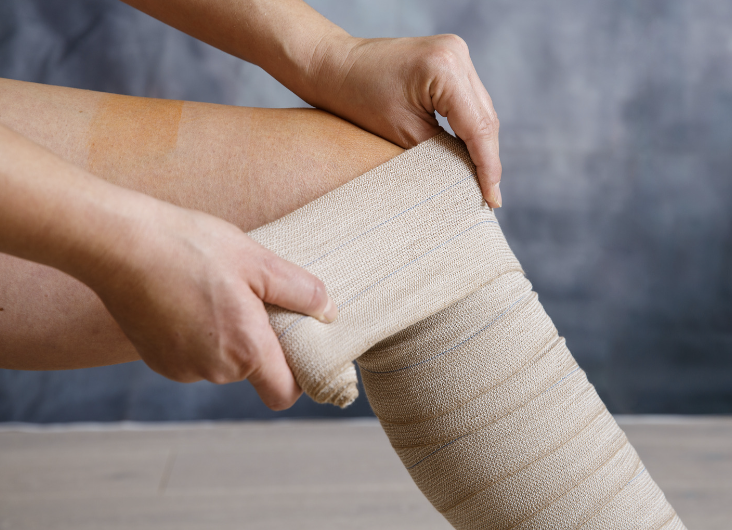 Bandaging For Swelling And Injuries