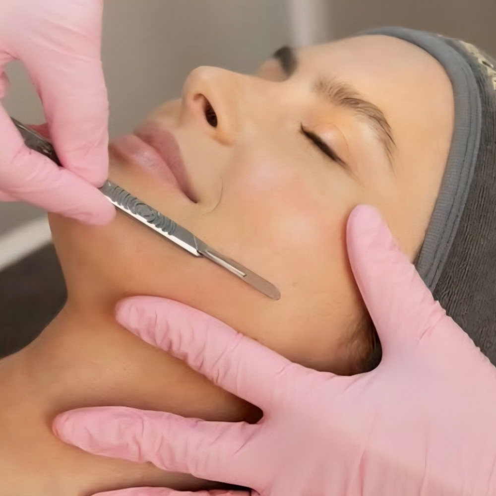 Content Dermaplaning Facial at Upton Aesthetics Cassy Upton L.E. in Suprise, AZ