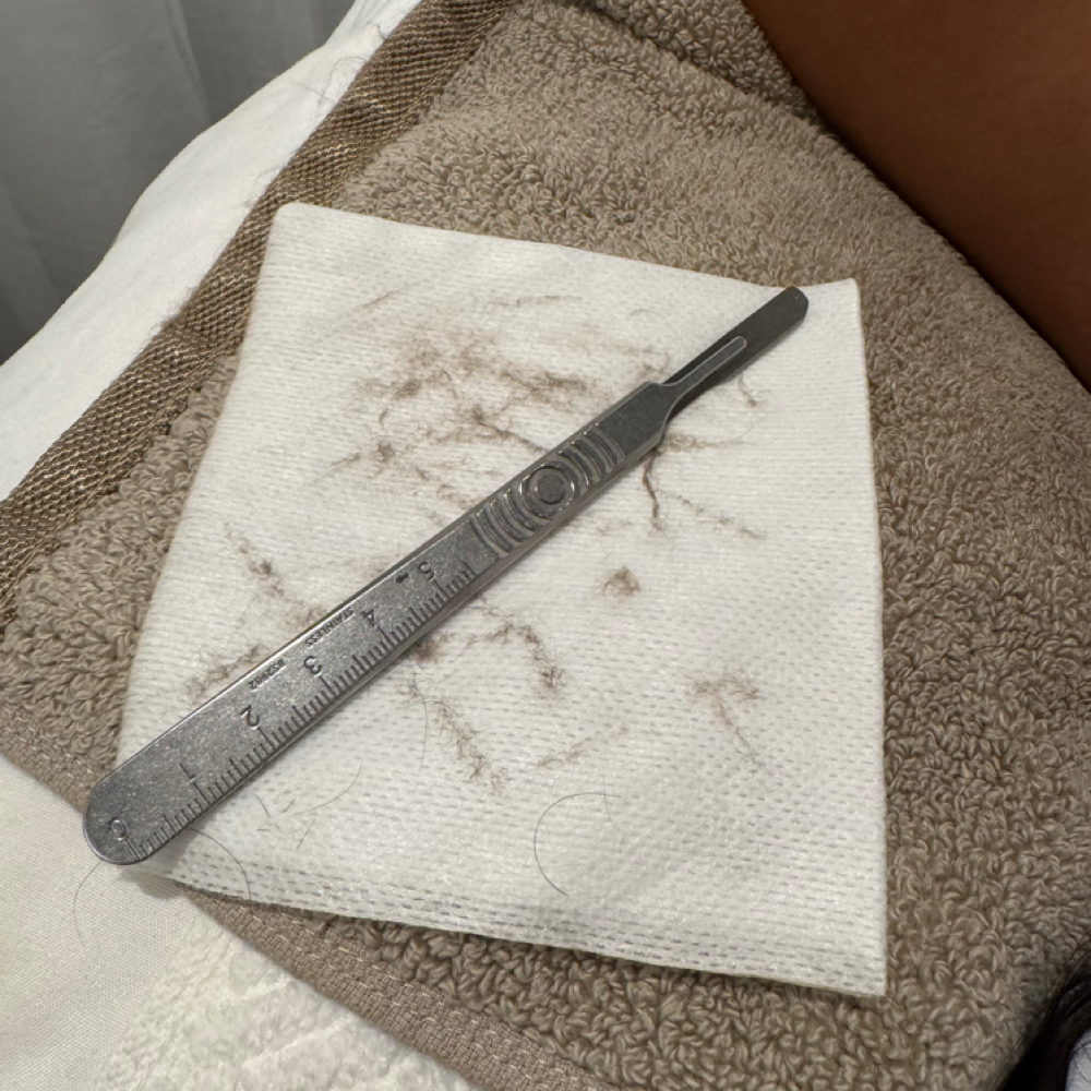 Dermaplane Facial at The Good Skin Studio in Los Angeles, CA
