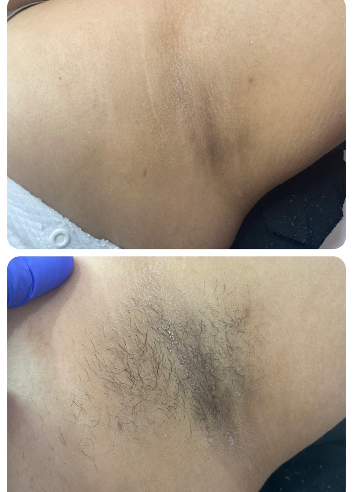 Under Arm Wax at Beauty Retreat in mt hope, WV