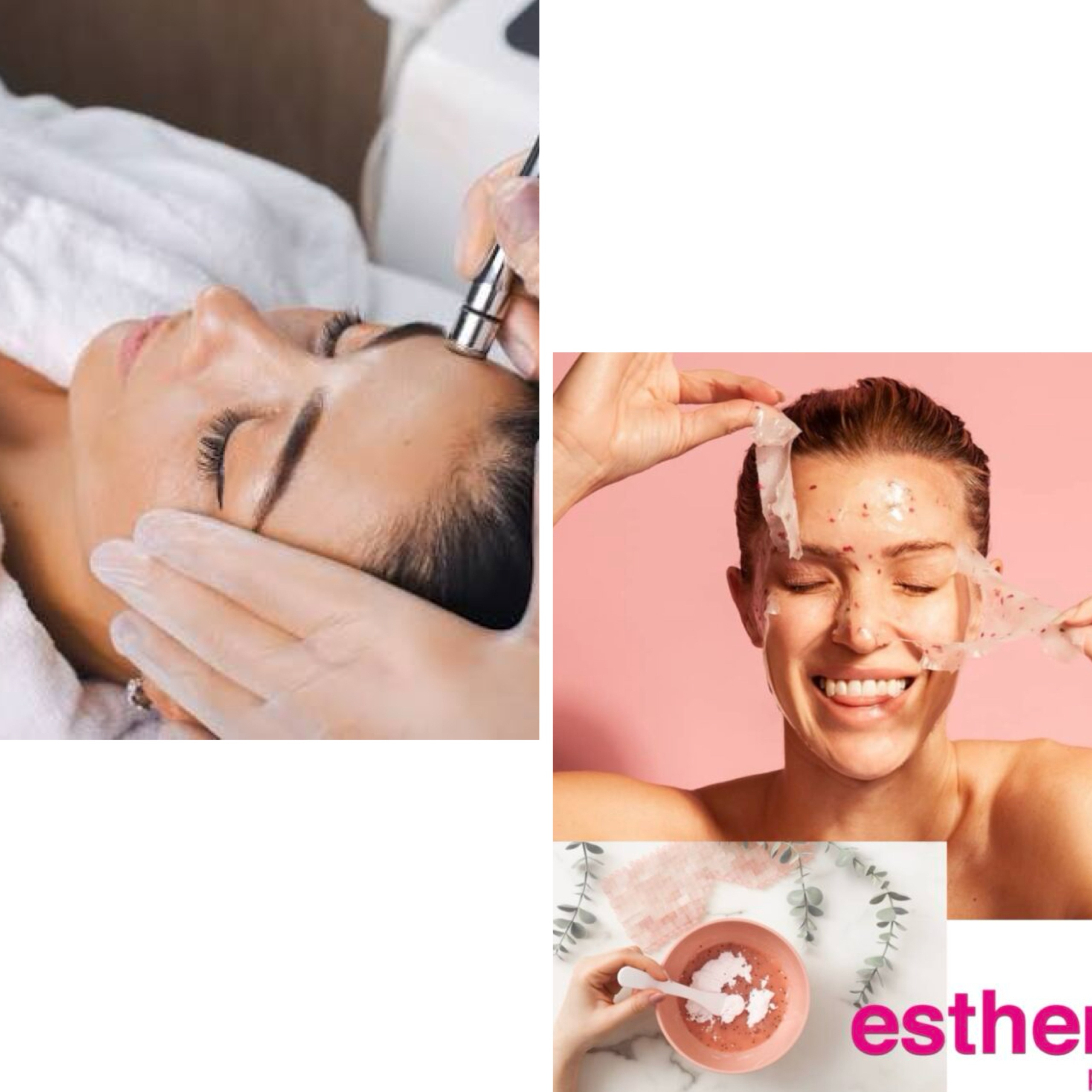 Microdermabrasion Facial at Look By Danella in Toledo, OH