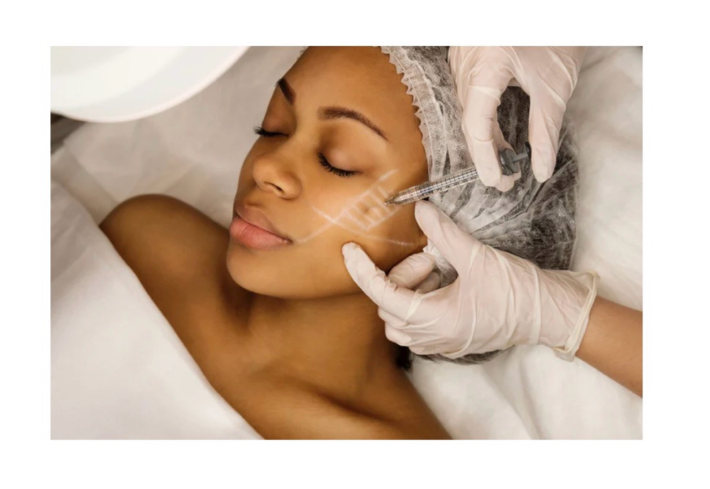 Dermal Filler