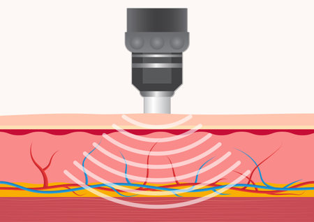 Microneedling at ELM Aesthetics and Wellness in San Antonio, TX