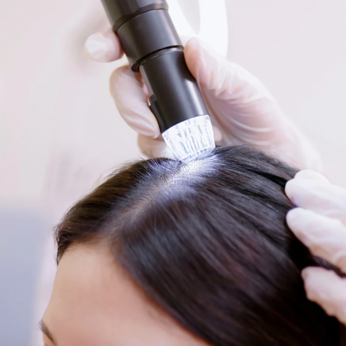 Scalp Treatment Maintenance