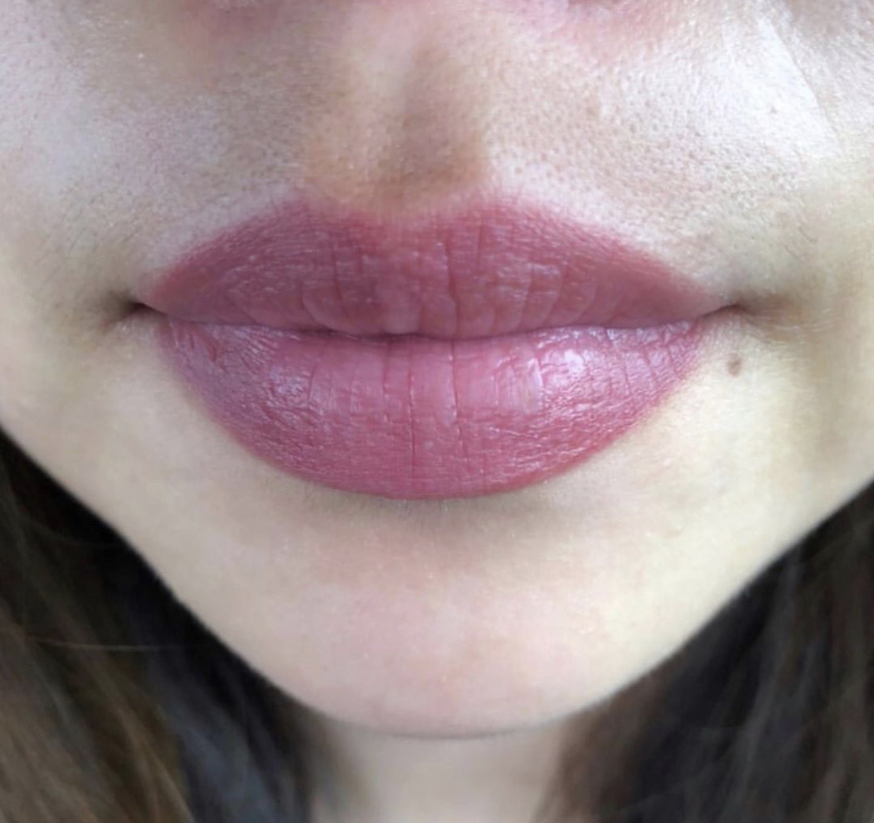 Lip Procedure Touch Ups