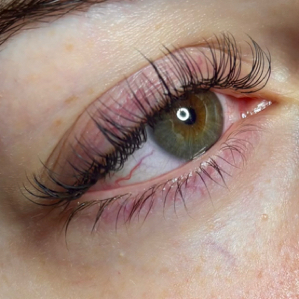 Fill: 3-week Classic at S.T. Esthetics in Michigan City, IN