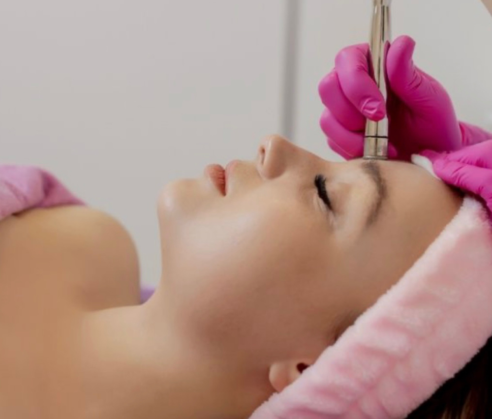 Microdermabrasion Facial