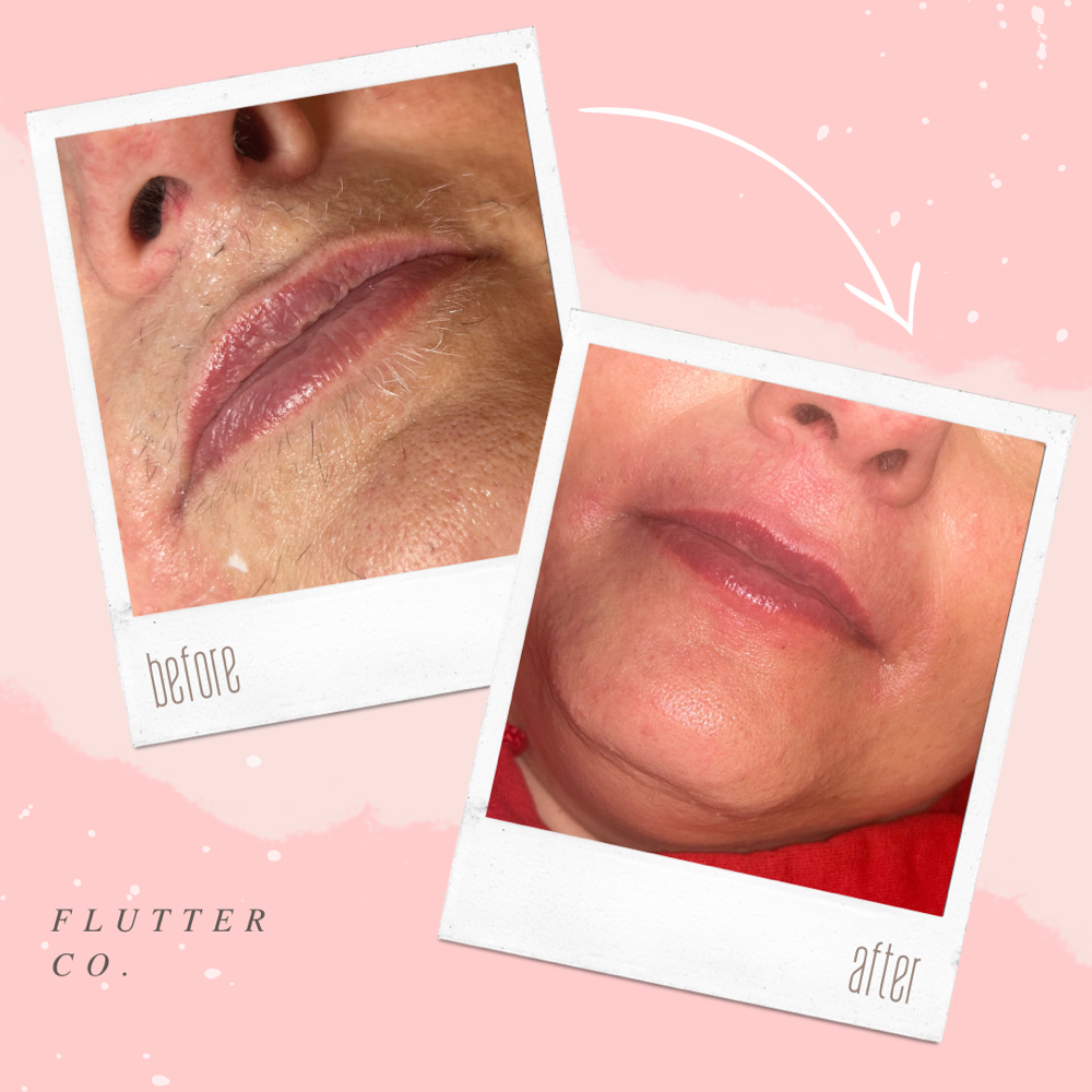 Lip