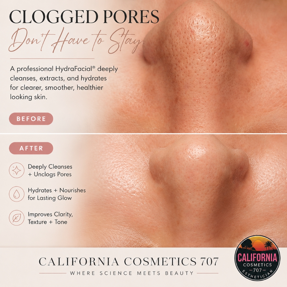 Oxygen Facial at California Cosmetics 707 in Mckinleyville, CA