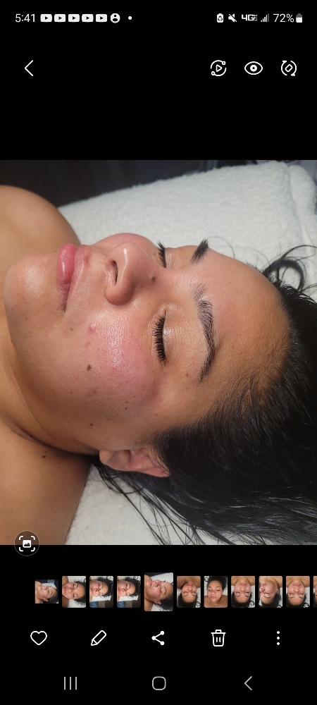 Oxygen Facial