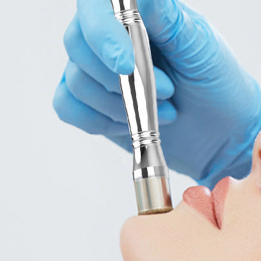 Diamond Dermabrasion-IntroPrice at Sun City Skin Studio in Socorro, TX