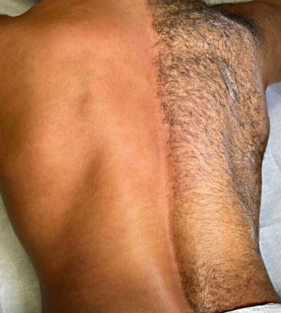 Men’s Full Back And Shoulders