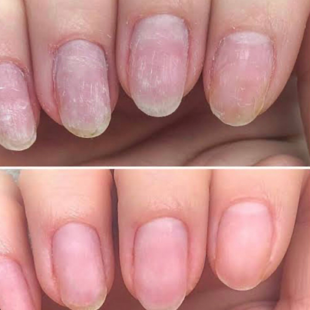 IBX Nail Treatment at Kind Hands Nail Studio in Lansing, IL