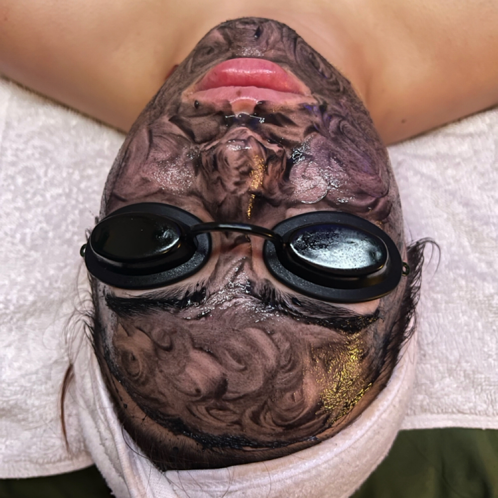 Custom Acne & Rosacea Facials