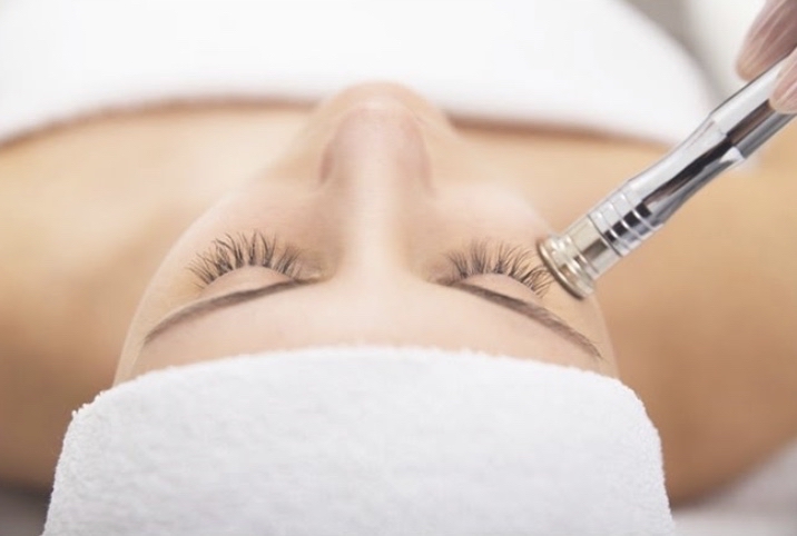 Microdermabrasion