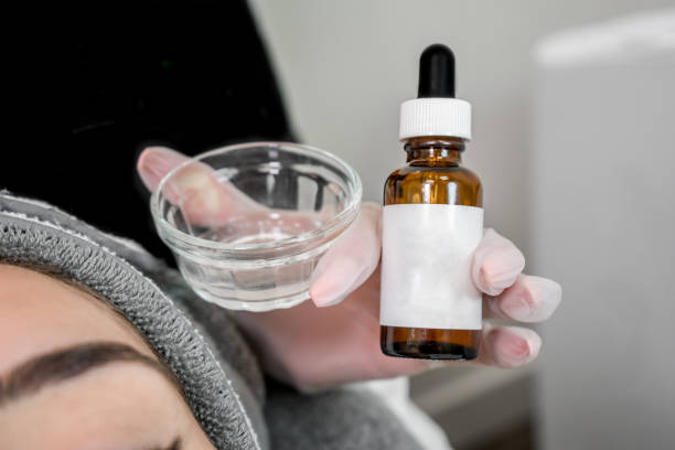 TCA 15% Peel Chemical Peel