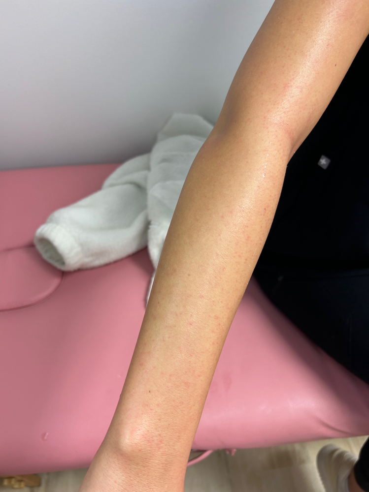 Full Arm