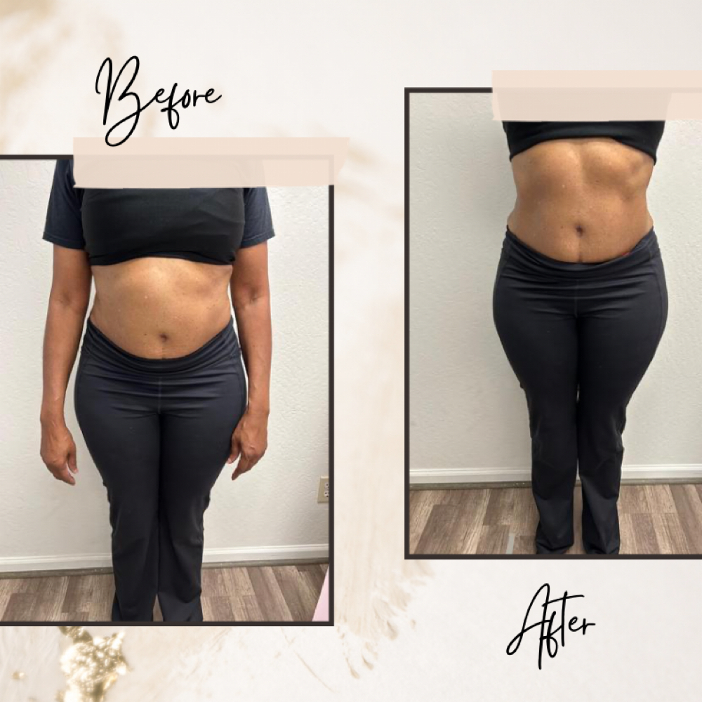 Waist Definition: Two-Area at Her Contour & Wellness, LLC in Antioch, CA