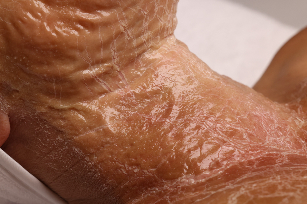 Zombie Facial at Aesthetics By Randi in Whitney, TX