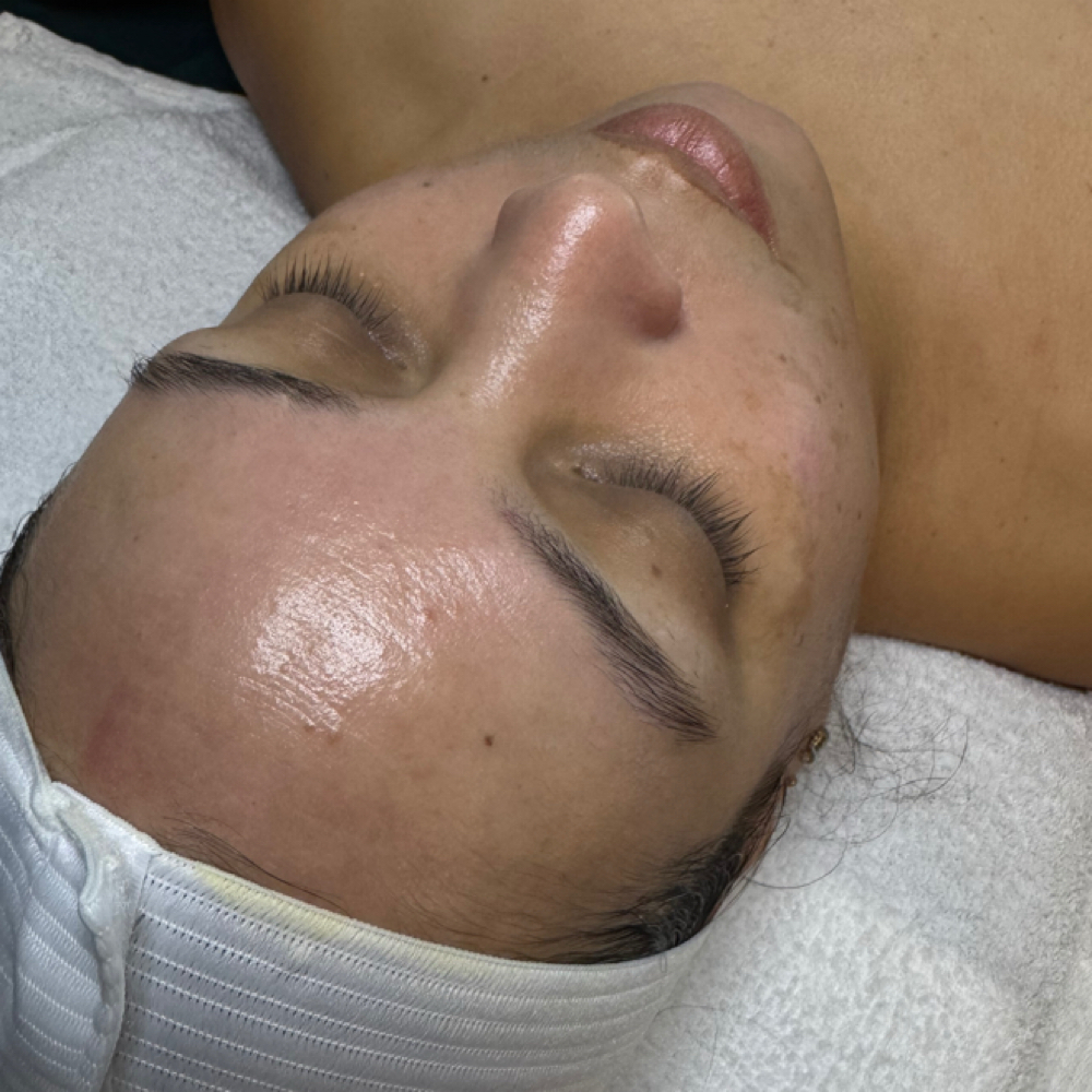 Facial Profundo Con Extracciones at Lizz S LashBeauty Studio in Philadelphia, PA