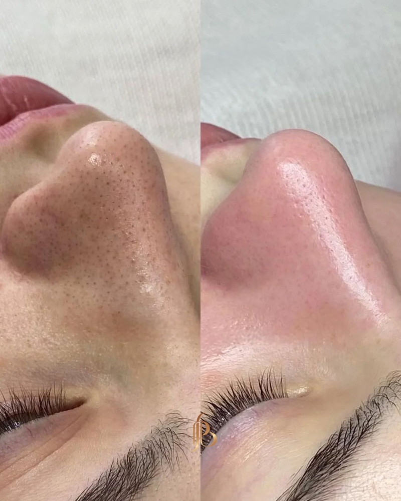 Pore Purifying Facial