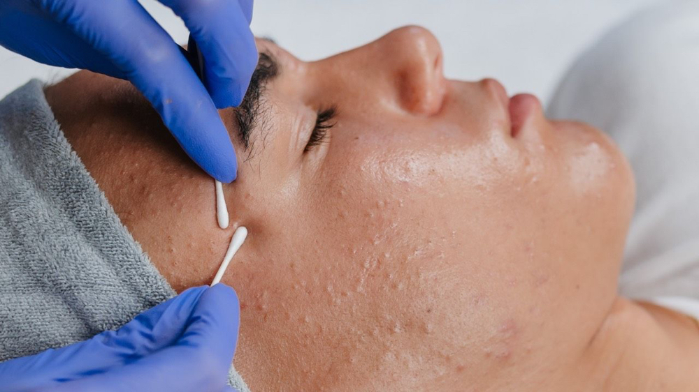 Clarifying Facial (Acne)