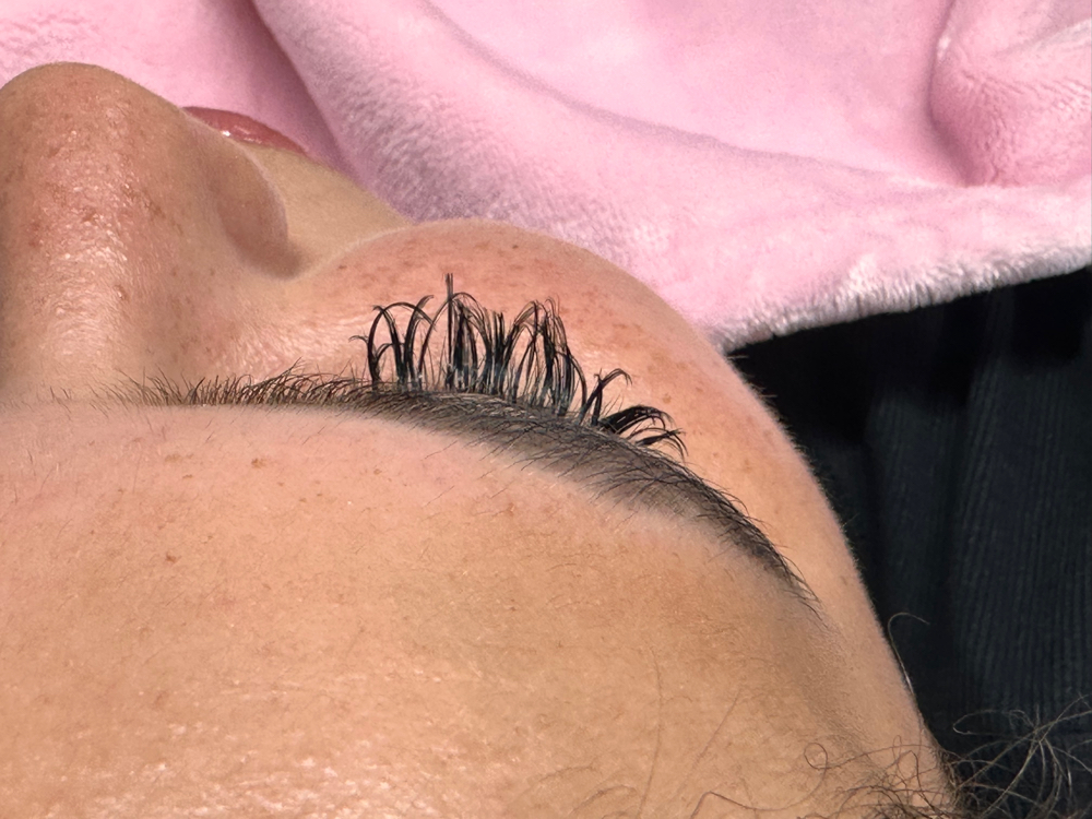 Lash Removal With Lash Set