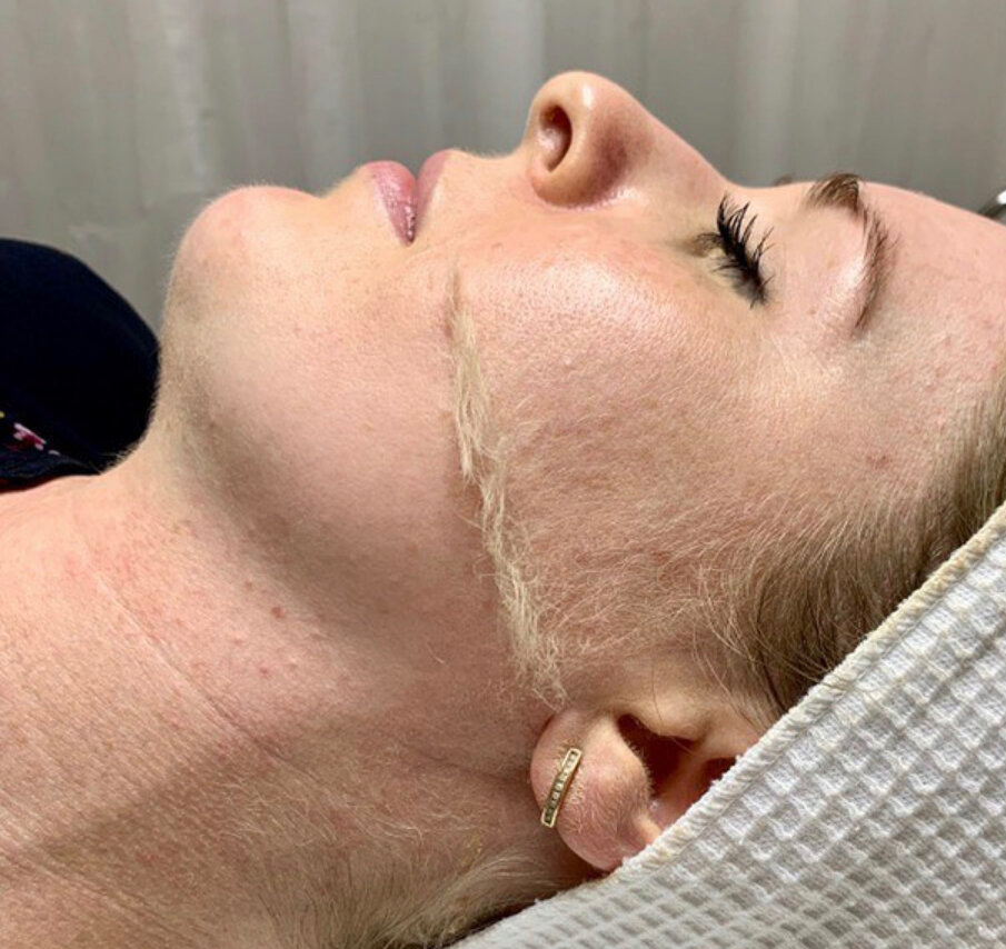 Dermaplane 60 Minute Facial