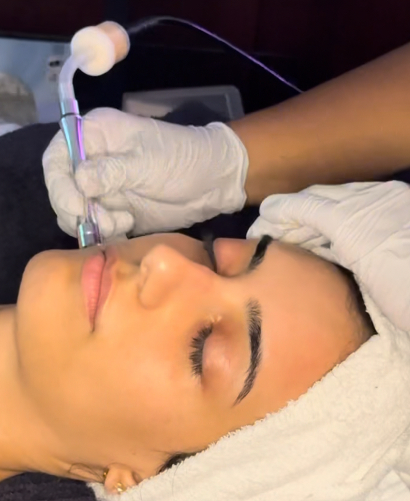 Diamond-Tipped Microdermabrasion