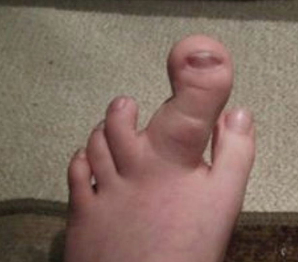wellness pedicure