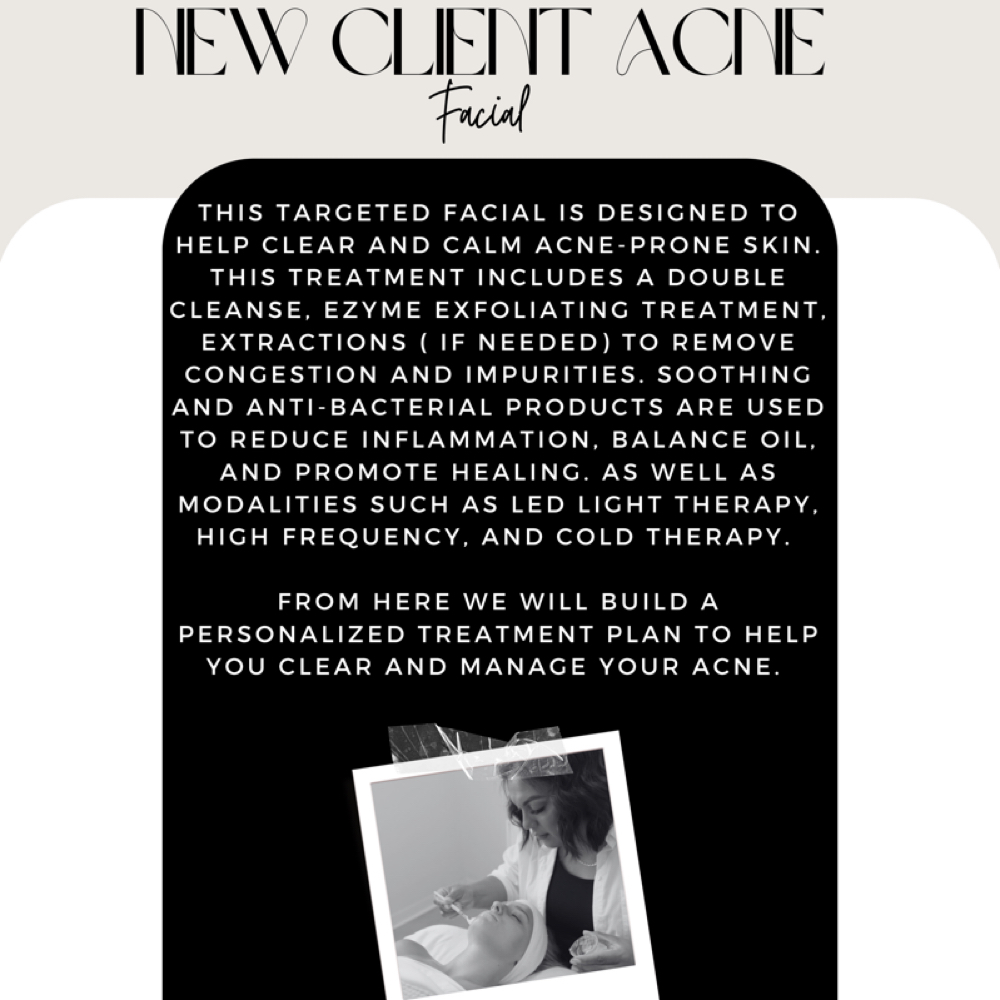 NEW CLIENT ACNE FACIAL at Aesthetics By Abigail Hernandez in Mustang, OK