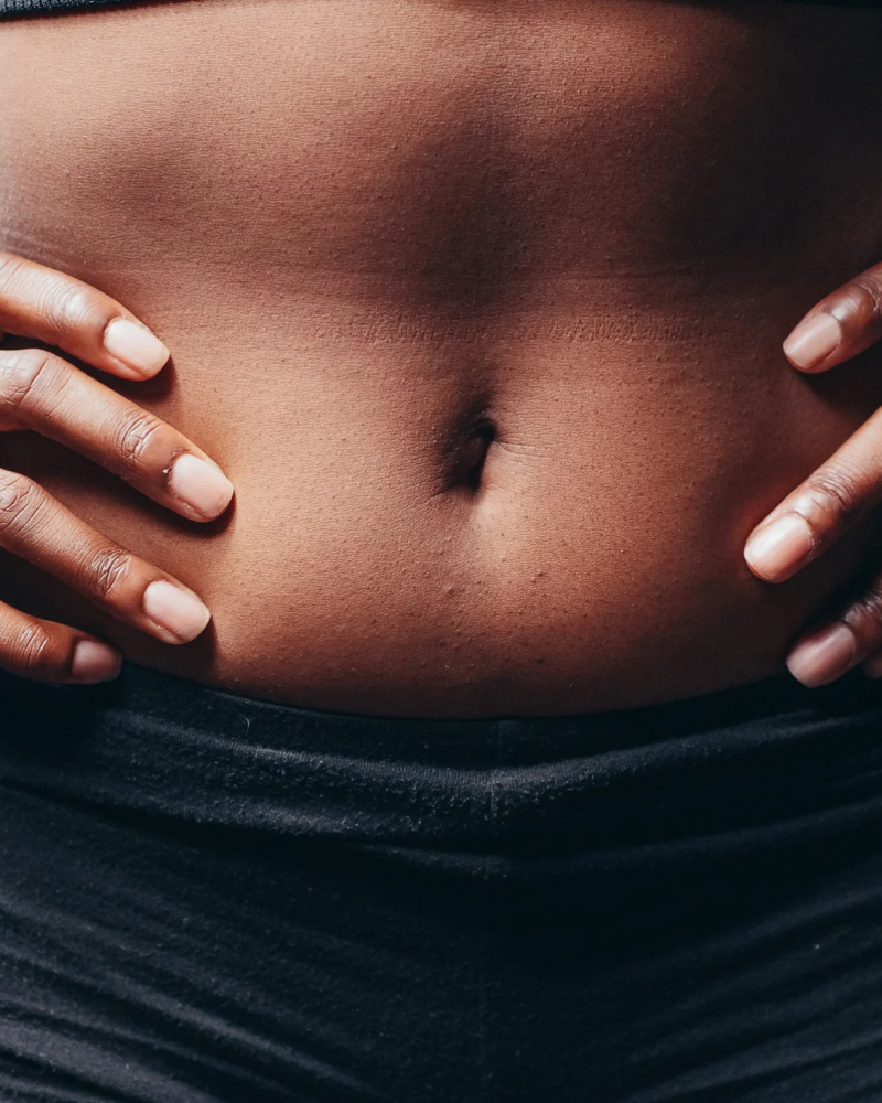 Full Stomach Laser Hair Removal at M.A.V Aesthetics in Fort Morgan, CO