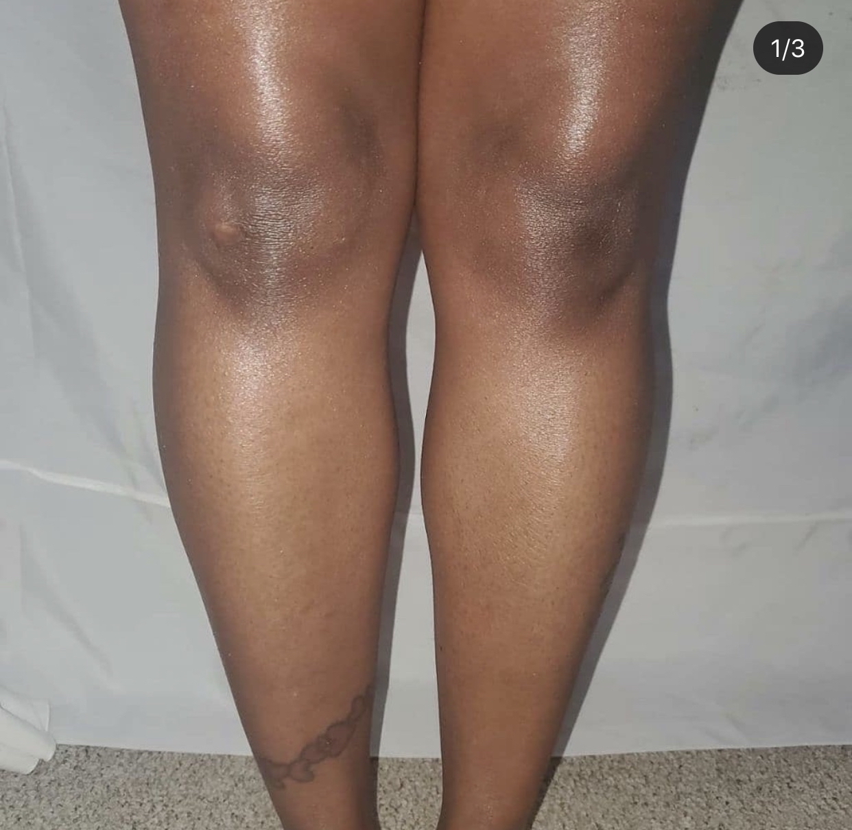 Lower Legs at BrandyLynn Permanent Cosmetic Makeup & Beauty in Ewing,, NJ