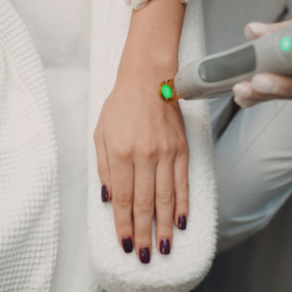 hands LASER HAIR REMOVAL at BEAUTY LAB COLLECTIVE in Miami, FL