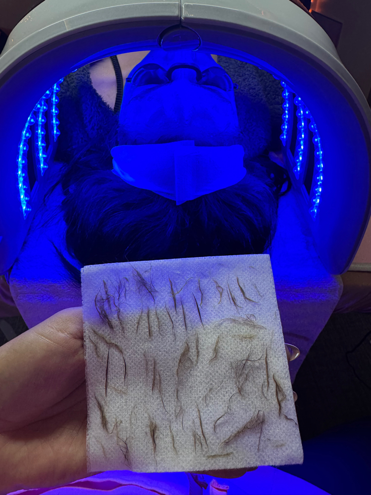 Dermaplane Facial at Destiny’s Beauty Lounge in Long Beach, CA