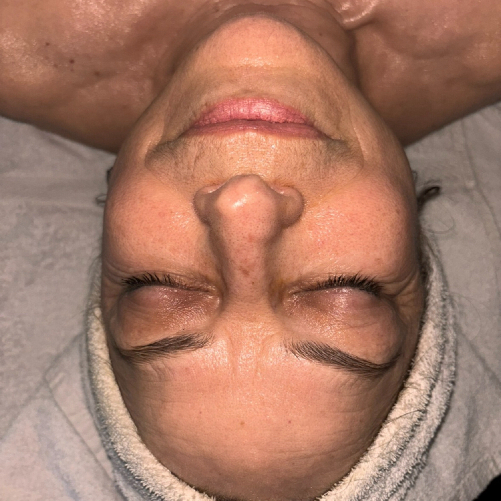 Refreshed Reef Facial at Pearly Derm in Sun valley, CA
