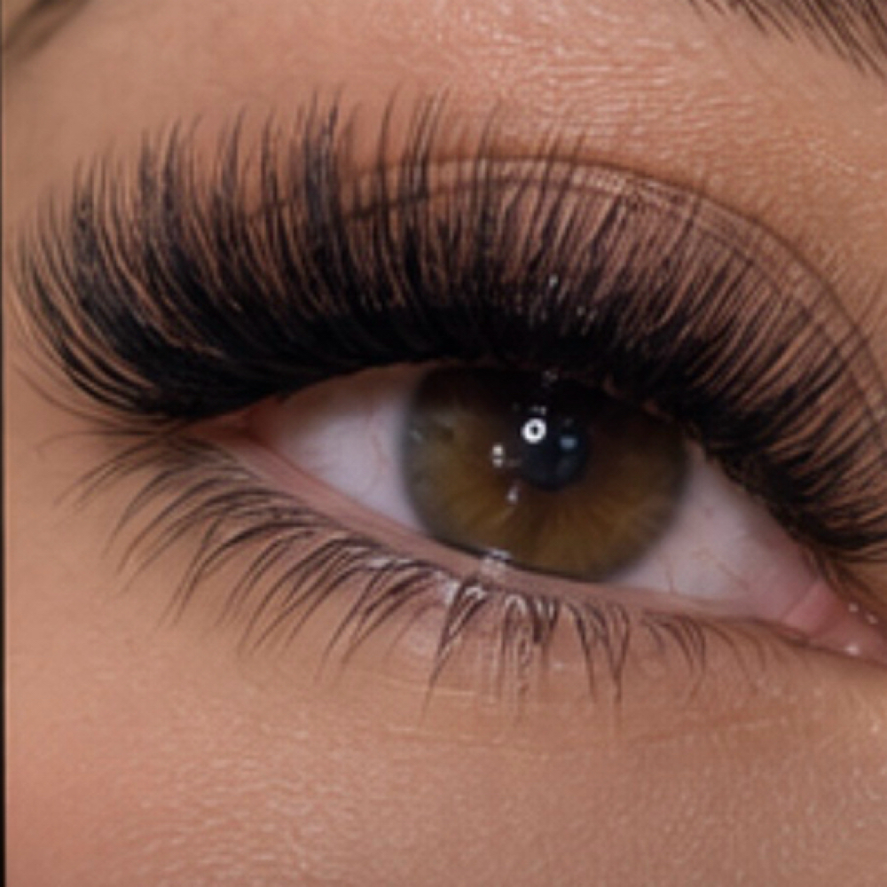 Volume Fill at Luma Esthetics in mechanicsburg, PA