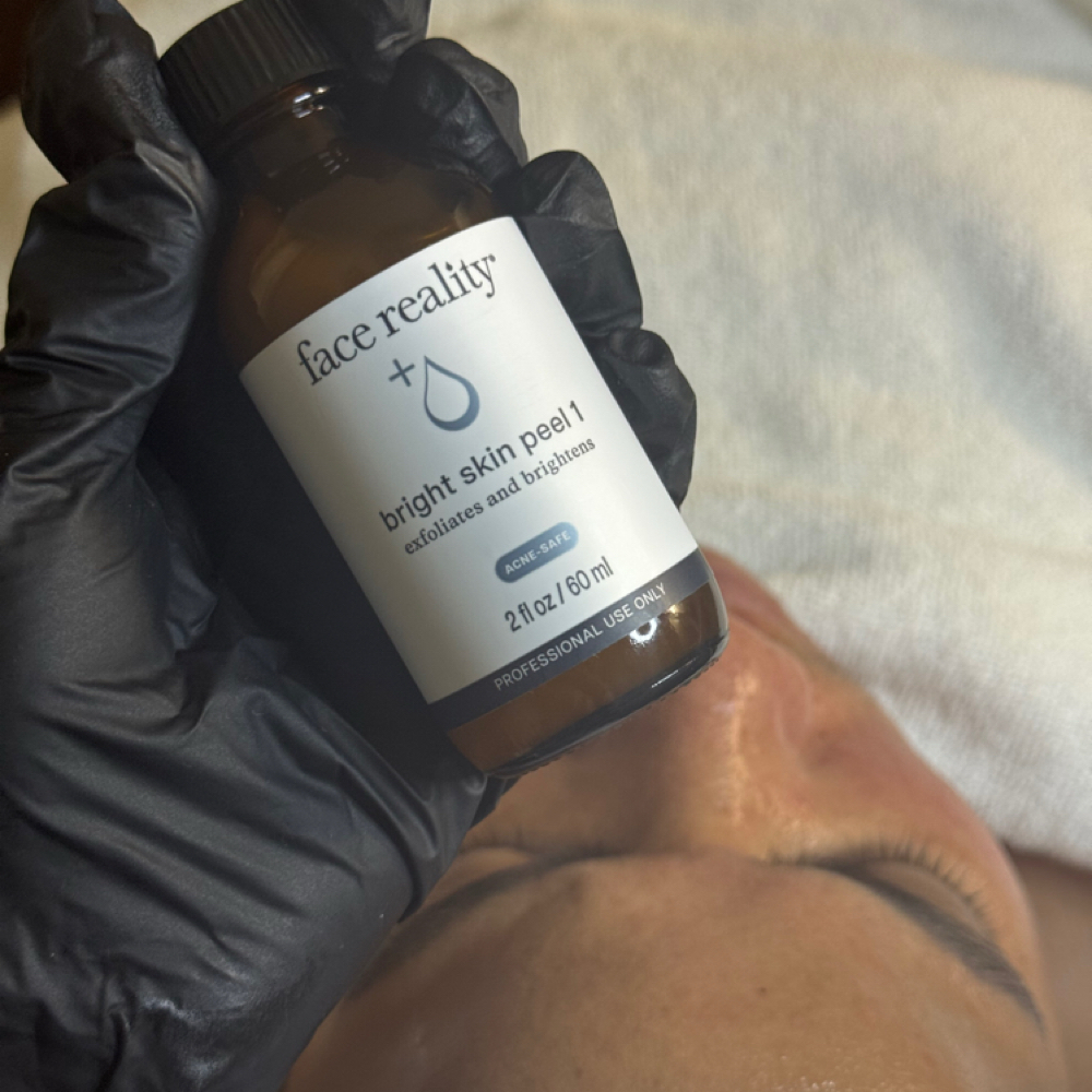 PEEL TREATMENTS at THE BEAUTY SPACE in Dorchester, MA