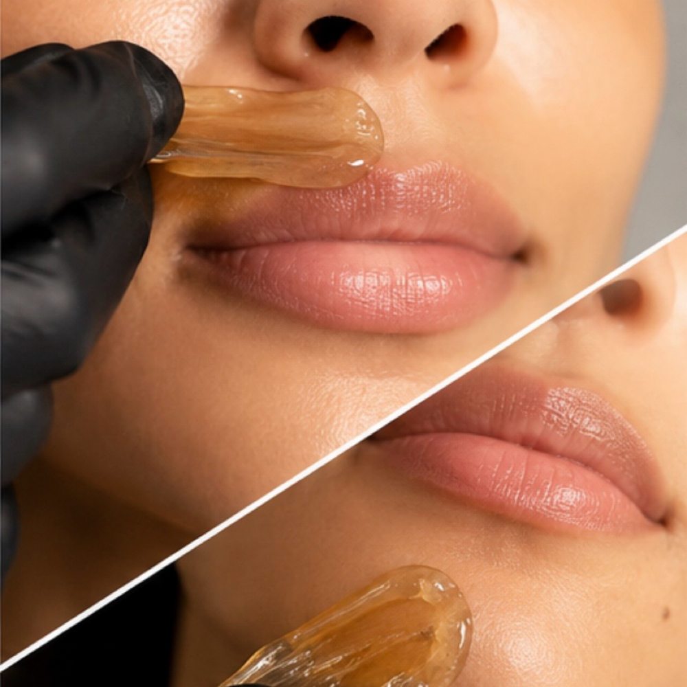 Upper Lip And Chin at Bare Karessence in Santa Clara, CA