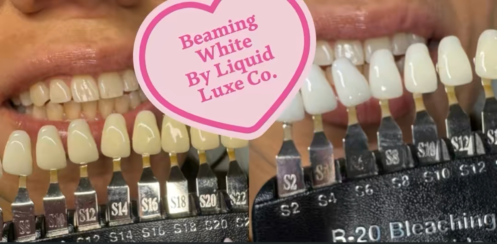 Teeth Whitening Gift & 50 0ff