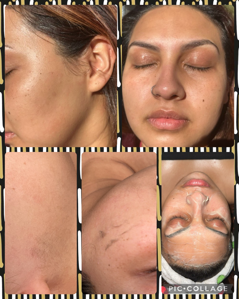 Osmosis Beauty Dermplaning Facial