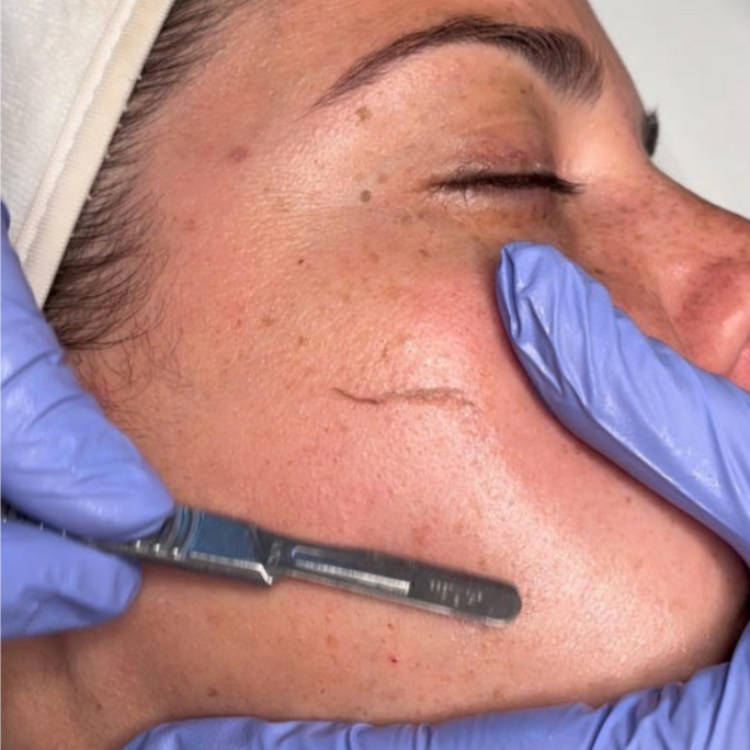 Dermaplane Facial at with love beauty bar in Brooklyn, NY