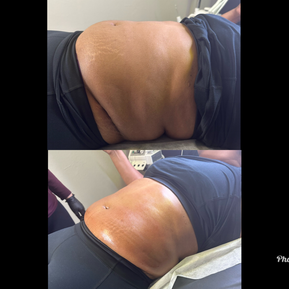 ⭐️ Signature 360 Sculpt at Waxxaholics Beauty & Body in Grand Prairie, TX