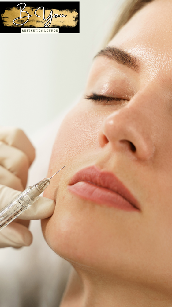 Perioral Filler at B’You Aesthetics Lounge in Pharr, TX