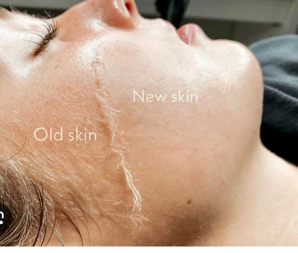 Express Dermaplane Treatment