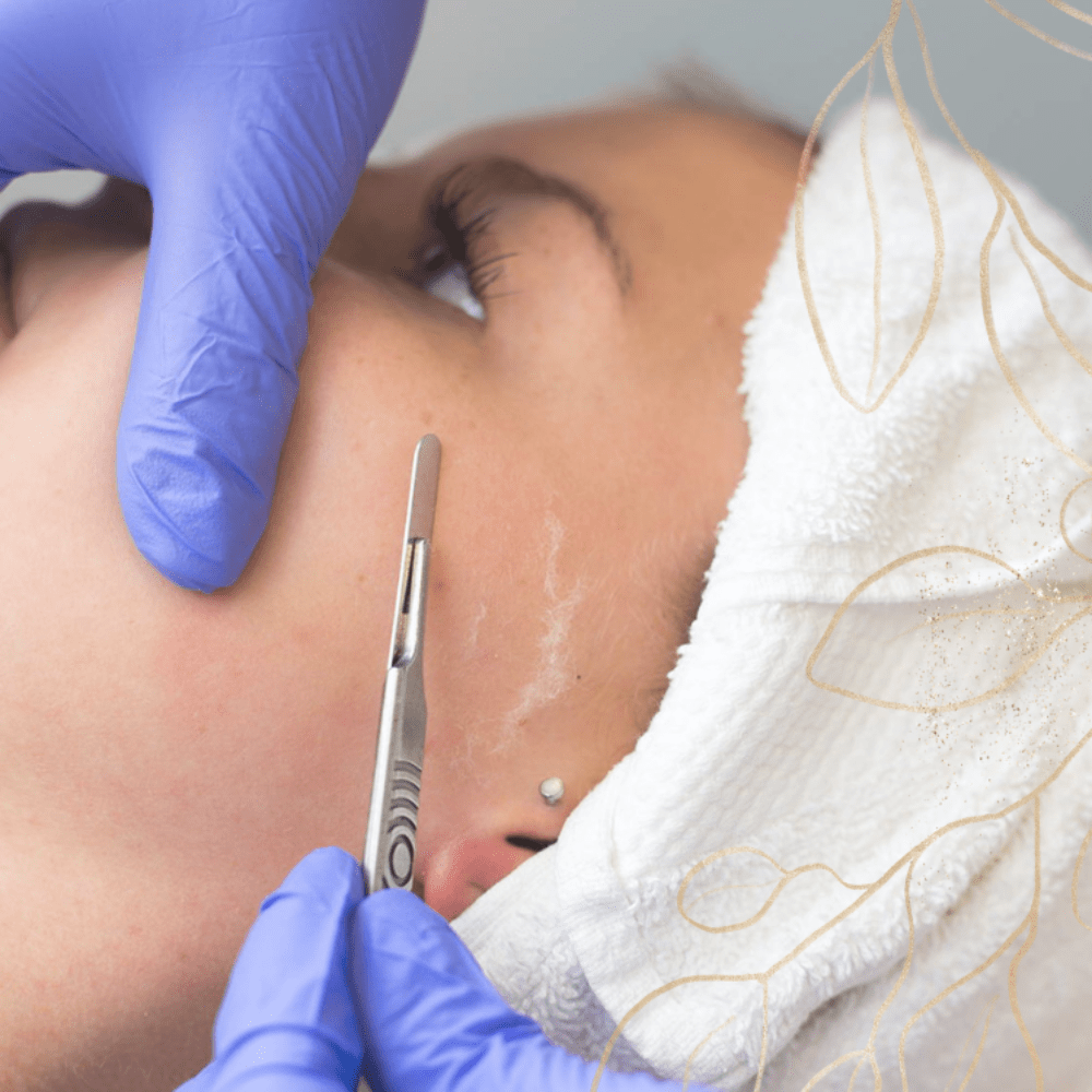 Dermaplane - Add On