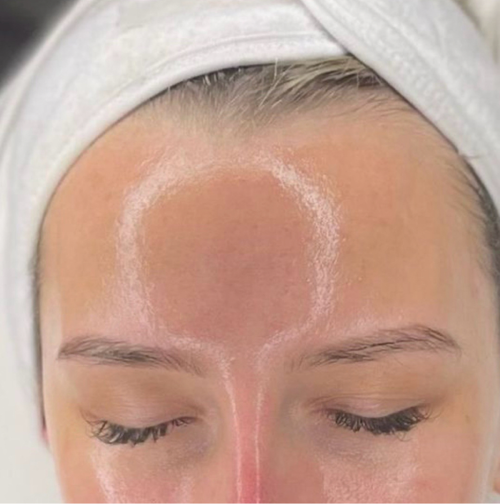 Glow & Go at Bridget  Wilson Skin in Downey, CA