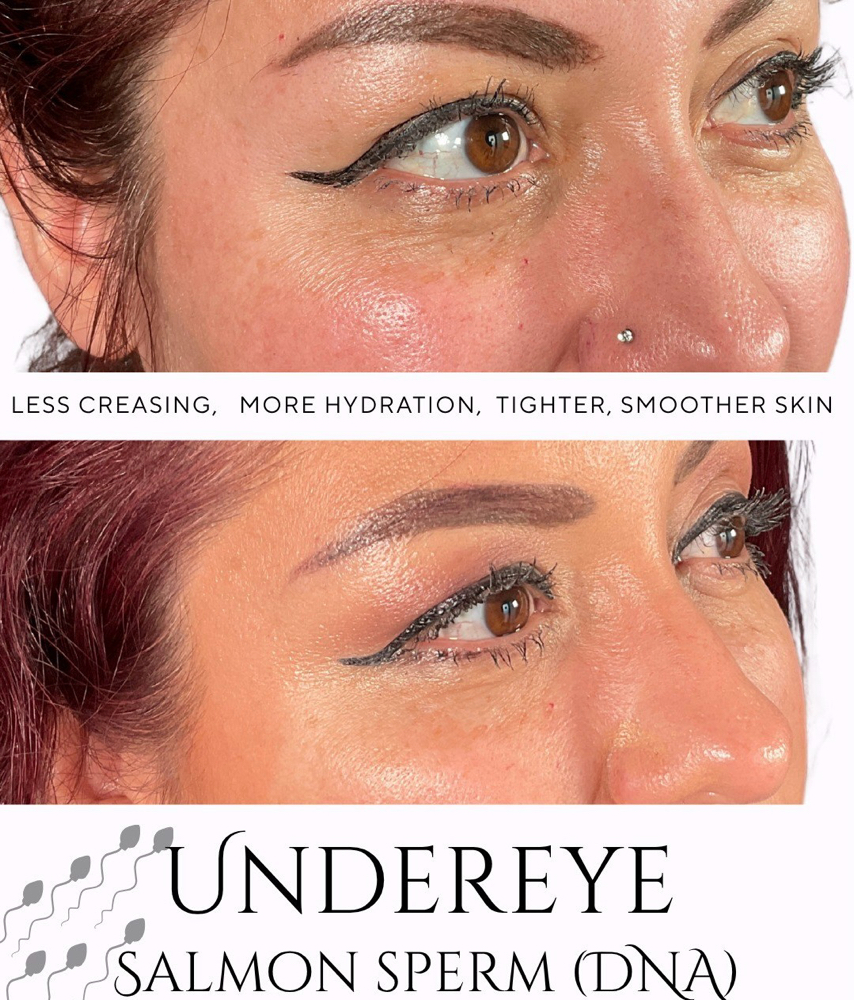 Under Eyes Natural  Rejuvenation